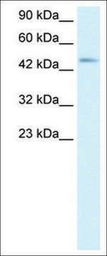 Anti-CCR8 antibody produced in rabbit IgG fraction of antiserum