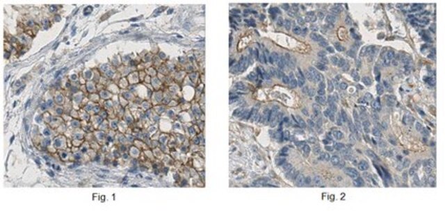 Anti-ADAM 17 Antibody, clone 16C11.1 | MABT388 clone 16C11.1, from mouse