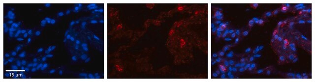 Anti-GPX3 antibody produced in rabbit affinity isolated antibody