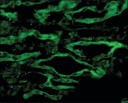 Anti-AQP4 antibody produced in rabbit 1&#160;mg/mL, affinity isolated antibody