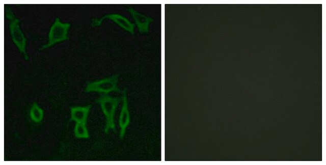 Anti-GRM5 antibody produced in rabbit affinity isolated antibody