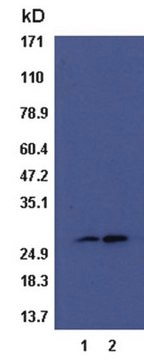 RalB Activation Assay Kit (non-radioactive) Non-radioactive Ral-B Activation Assay Kit can be used to precipitate Ral-B-GTP from cell lysates &amp; detection by a Ral-B specific monoclonal antibody.