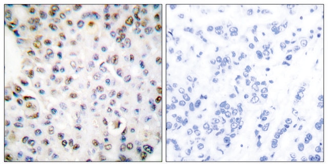 Anti-Retinoid X Receptor &#947; antibody produced in rabbit affinity isolated antibody