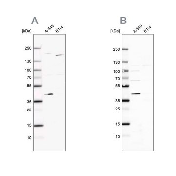 Anti-GALK1 antibody produced in rabbit Ab1, Prestige Antibodies&#174; Powered by Atlas Antibodies, affinity isolated antibody, buffered aqueous glycerol solution