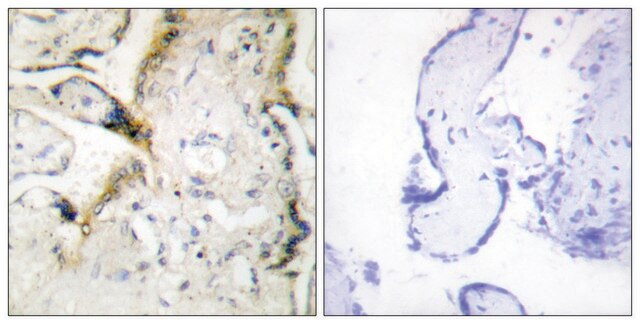 Anti-LAMA2 antibody produced in rabbit affinity isolated antibody