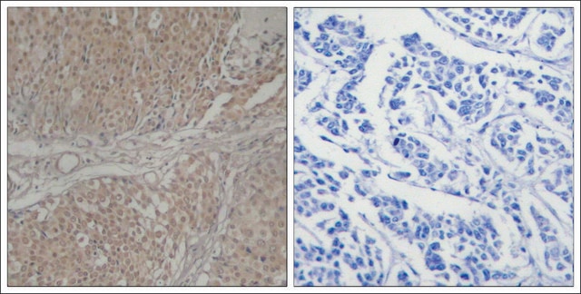 Anti-SMAD3 (Ab-208) antibody produced in rabbit affinity isolated antibody