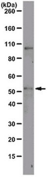 Anti-ODC1 Antibody, clone CPTC-ODC1-2 clone CPTC-ODC1-2, from mouse