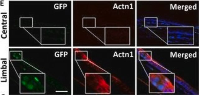 Anti-ACTN1 antibody produced in rabbit Prestige Antibodies&#174; Powered by Atlas Antibodies, affinity isolated antibody, buffered aqueous glycerol solution