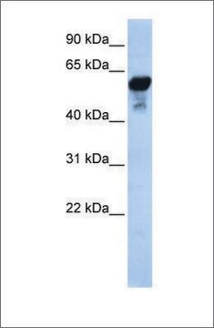 Anti-ALDH1B1 antibody produced in rabbit affinity isolated antibody