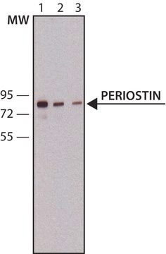 Anti-Periostin antibody,Mouse monoclonal clone 47, purified from hybridoma cell culture