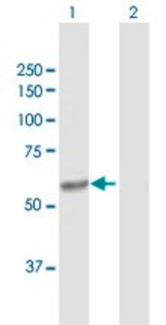 Anti-CYP4V2 antibody produced in rabbit purified immunoglobulin, buffered aqueous solution