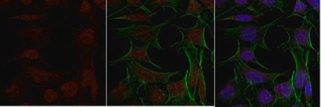 Anti-TFE3 from rabbit, purified by affinity chromatography