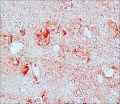 Anti-Nitrotyrosine antibody produced in rabbit affinity isolated antibody, buffered aqueous solution