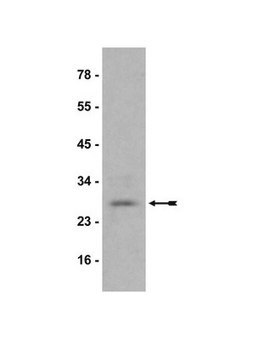 Anti-HP1&#945; Antibody, clone15.19s2 clone 15.19s2, Upstate&#174;, from mouse