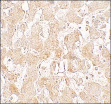 Anti-UCP1 antibody produced in rabbit affinity isolated antibody