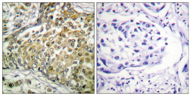 Anti-p53 (Acetyl-Lys379), C-Terminal antibody produced in rabbit affinity isolated antibody