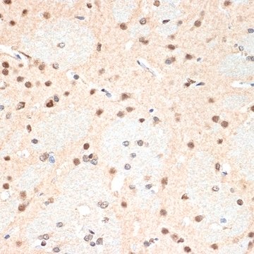 Anti-PSMA2 antibody produced in rabbit