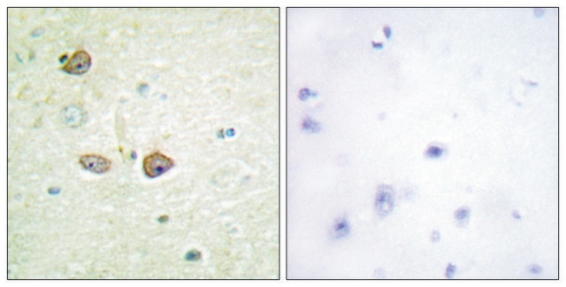 Anti-5-HT-1B antibody produced in rabbit affinity isolated antibody