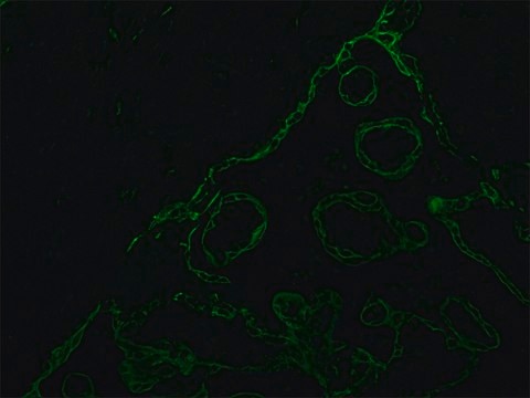 Monoclonal Anti-Cytokeratin Peptide 18 antibody produced in mouse clone KS-B17.2, ascites fluid