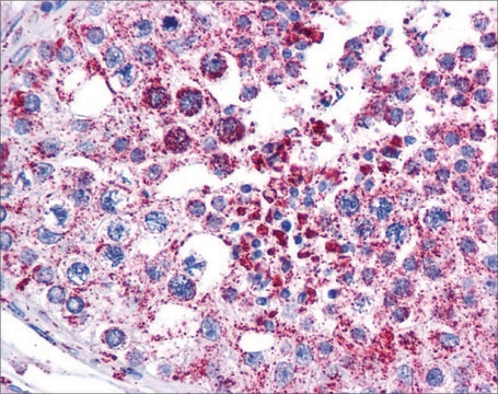 Anti-MAGEA3 antibody produced in rabbit affinity isolated antibody