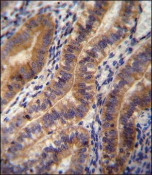 ANTI-ANGPT2 (C-TERM) antibody produced in rabbit IgG fraction of antiserum, buffered aqueous solution