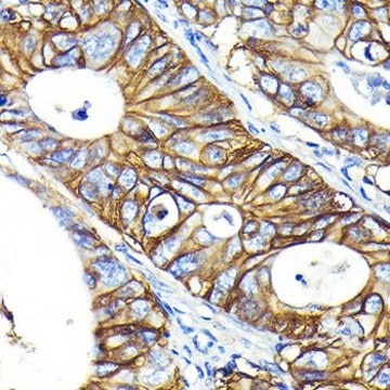 Anti-CD46 antibody produced in rabbit