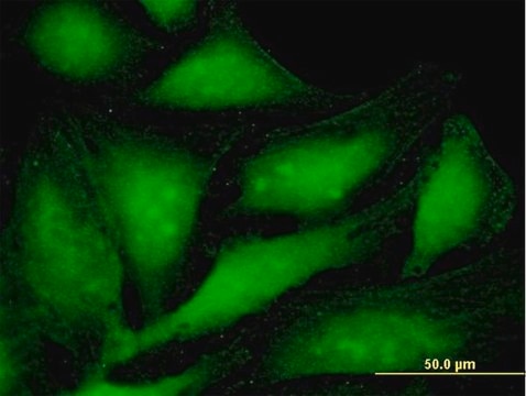 Anti-PSME1 antibody produced in mouse purified immunoglobulin, buffered aqueous solution