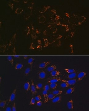 Anti-Glutaminase (GLS) antibody produced in rabbit