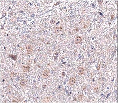 Anti-SAPAP3 Antibody from rabbit, purified by affinity chromatography