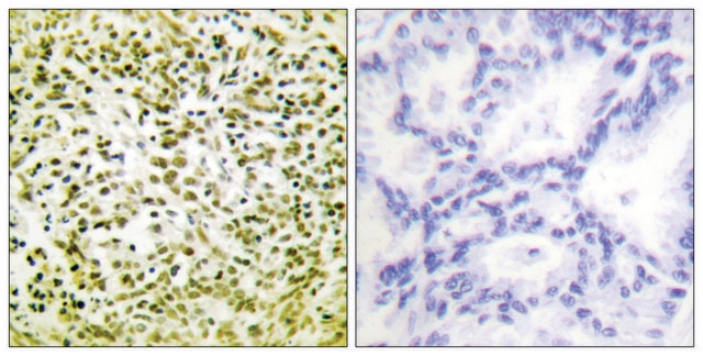 Anti-p53 antibody produced in rabbit affinity isolated antibody