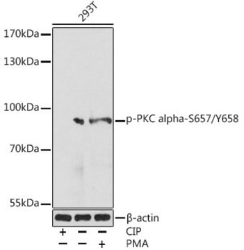 Anti-Phospho-PKC alpha-S657/Y658 antibody produced in rabbit