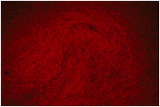 Alizarin-Red Staining Solution Alizarin red is a commonly used stain to identify calcium containing osteocytes in differentiated culture of both human and rodent mesenchymal stem cells (MSCs).