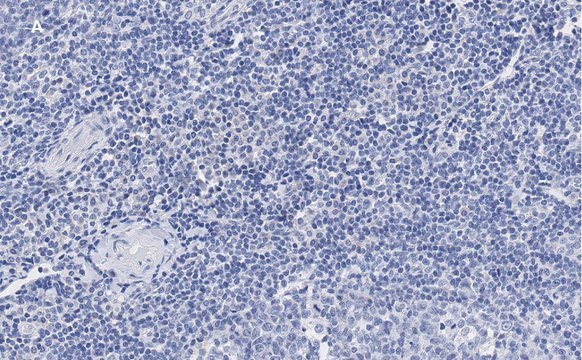 Anti-vWF Antibody, clone 1B21, ZooMAb&#174; Rabbit Monoclonal recombinant, expressed in HEK 293 cells