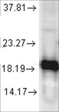 Anti-SOD1 antibody produced in rabbit 1&#160;mg/mL, affinity isolated antibody