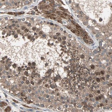 Anti-ZNF608 antibody produced in rabbit Prestige Antibodies&#174; Powered by Atlas Antibodies, affinity isolated antibody, buffered aqueous glycerol solution