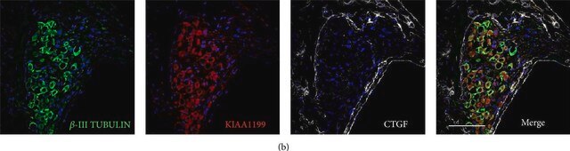 Monoclonal Anti-&#946;-Tubulin III antibody produced in mouse clone SDL.3D10, ascites fluid