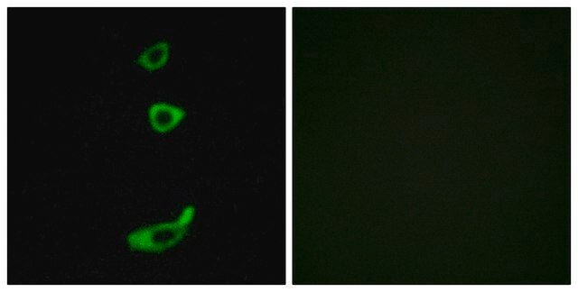 Anti-CRHR1 antibody produced in rabbit affinity isolated antibody