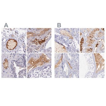 Anti-KNG1 antibody produced in rabbit Ab1, Prestige Antibodies&#174; Powered by Atlas Antibodies, affinity isolated antibody, buffered aqueous glycerol solution