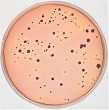 MacConkey-Sorbitol Agar NutriSelect&#174; Plus, suitable for microbiology