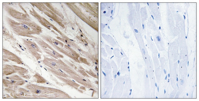 Anti-MYBPC3 antibody produced in rabbit affinity isolated antibody