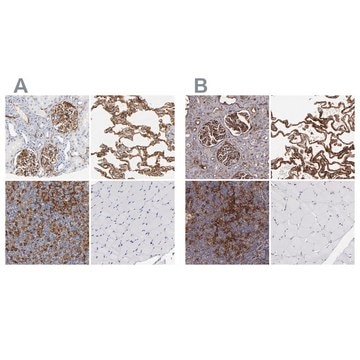 Anti-ICAM1 antibody produced in rabbit Prestige Antibodies&#174; Powered by Atlas Antibodies, affinity isolated antibody, buffered aqueous glycerol solution