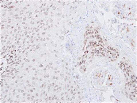 Anti-NFE2L2 antibody produced in rabbit