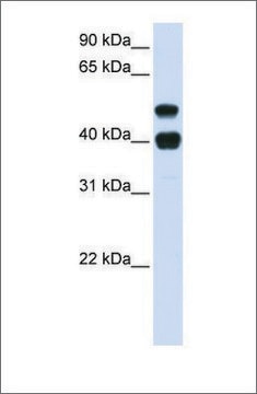 Anti-USP22 (ab1) antibody produced in rabbit affinity isolated antibody