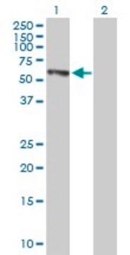 Anti-EPHX2 antibody produced in mouse IgG fraction of antiserum, buffered aqueous solution