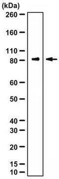 Anti-HMMR Antibody/CD168 from rabbit, purified by affinity chromatography