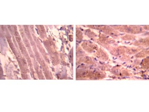 Anti-Atrial Natriuretic Polypetide Antibody, alpha from rabbit