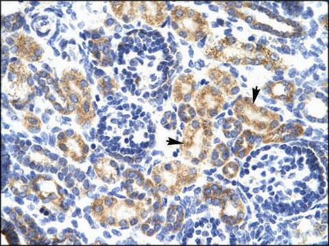 Anti-P2RX7 antibody produced in rabbit IgG fraction of antiserum