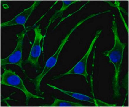 Anti-PTH1R Antibody, clone 4D2 ascites fluid, clone 4D2, from mouse