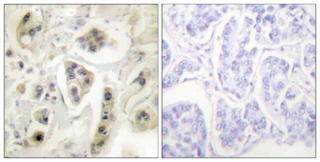 Anti-HSP60 antibody produced in rabbit affinity isolated antibody