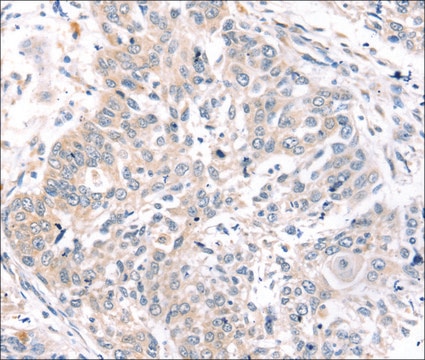 Anti-ROR1 affinity isolated antibody